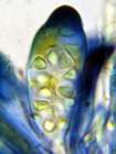Caloplaca flavescens (Huds.) J. R. Laundon