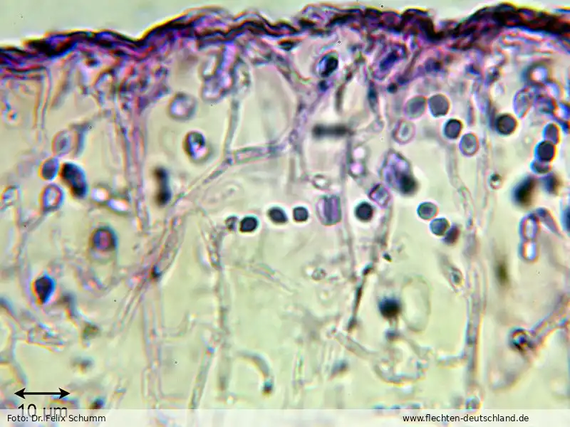 Mikromerkmale | Foto von Dr. Felix Schumm