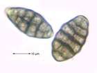 Diploschistes scruposus (Schreb.) Norman