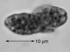 Gyalecta jenensis (Batsch) Zahlbr.