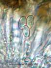 Lecanora persimilis Th. Fr.