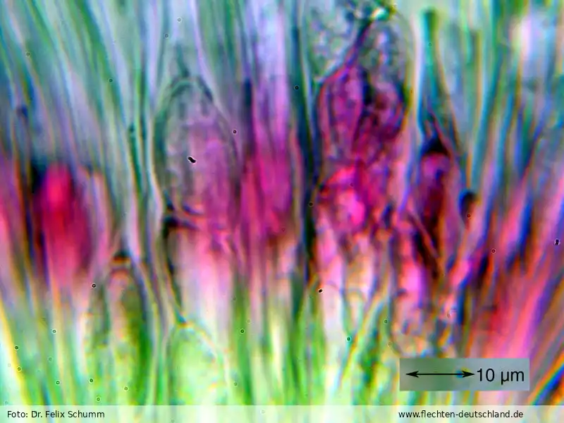 Sporen | Foto von Dr. Felix Schumm