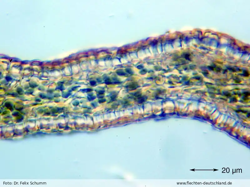 Mikromerkmale | Foto von Dr. Felix Schumm