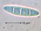 Mycobilimbia microcarpa (Th. Fr.) Brunnb.