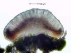 Mycobilimbia sabuletorum (Schreber) Hafellner