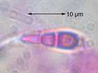 Opegrapha dolomitica (Arnold) Clauzade & Cl. Roux ex Torrente & Egea