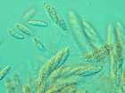 Pronectria xanthoriae Lowen & Diederich