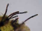 Taeniolella phaeophysciae D. Hawksw.